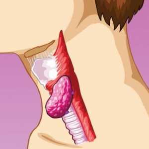 Cauze și simptome de inflamație a ganglionilor limfatici pe gât