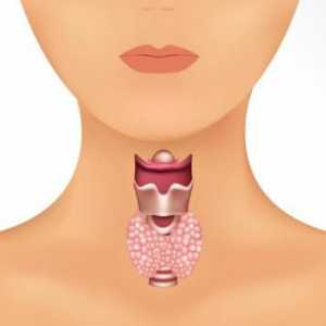 Semne de glandă tiroidă la femei - nu încă o propoziție