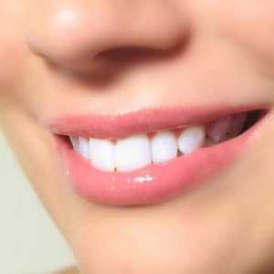 Procedura de albire a dinților: recenzii și recomandări