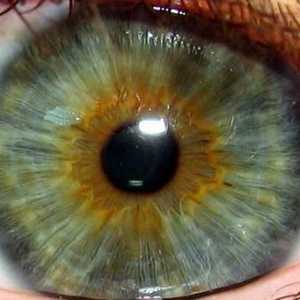 Iris de ochi: culoare, pete, boli