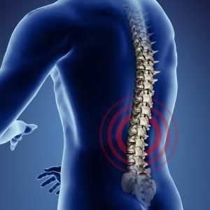 Spondiloza coloanei vertebrale lombare: cauze, simptome și metode de tratament