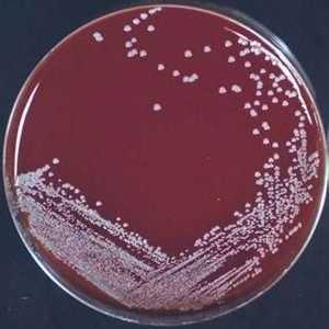 Staphylococcus epidermidis (stafilococ epidermis) - simptome, cauze, tratament. Care este norma în…