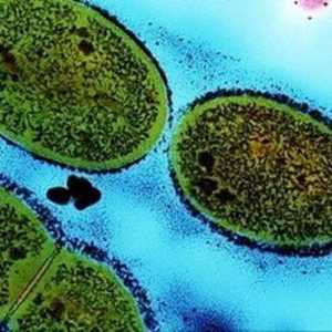 Streptococcus - ce este? Tipuri de streptococi