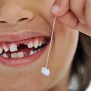 Este o schimbare teribilă a dinților la un copil, așa cum gândesc părinții?