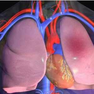Tromboembolismul ramurilor mici ale arterei pulmonare: cauze, simptome și diagnostice