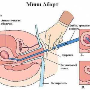 Vacuum întreruperii sarcinii: sincronizare și revizuiri
