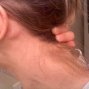 Au limfonoduri în spatele unei urechi inflamate? Principalul lucru este să lupți împotriva…