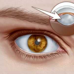 Bolile oculare la om: nume, simptome și tratament, fotografie