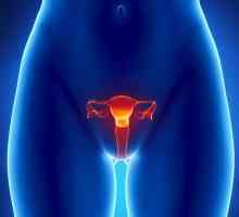 Adenocarcinomul uterului: etape, tratament, prognostic