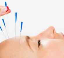 Punctele de acupunctura asupra corpului uman