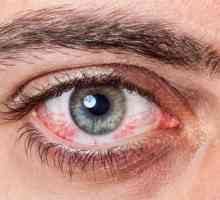 Alergie la ochi: cum să tratezi, modalități eficiente și recomandări