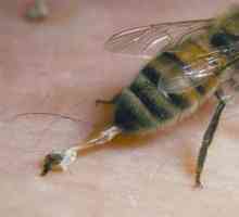 Alergia la arsurile de albine: prim ajutor, consecințe