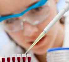 Test de sânge pentru fracțiunile de proteine