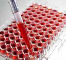 Testul de sânge pentru tuberculoză: trăsături, tipuri și transcripție