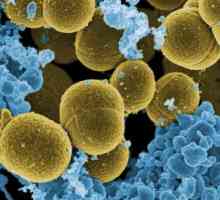 Analiza Staphylococcus: cum să luați și unde să vă predați