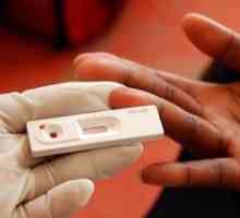 Testarea HIV: momentul de pregătire, unde și când să luați