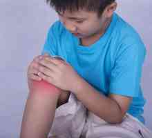 Artrita la copii: cauze, semne, simptome și caracteristici ale tratamentului
