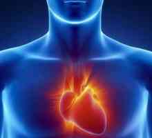 Asistul inimii - ce este? Simptomele, cauzele, tratamentul de urgență, tratamentul