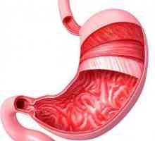 Atonia stomacului: cauze, simptome, diagnostic și tratament