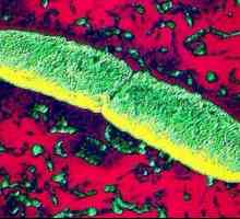 Bacteriul "bacilului de ciumă": descriere, caracteristici și tratamentul infecției