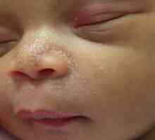 Puncte albe pe nasul nou-născutului. De ce nou-nascutul are puncte albe pe nas? Când se trec…