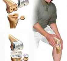 Durerea în genunchi când stați ghemuit și în picioare. Tratamentul cu remedii folclorice