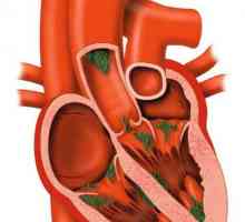 Boala inimii palpabile: simptome și tratament