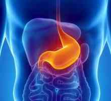 Boli ale stomacului: simptome, tratament, dietă. Diagnosticul și prevenirea bolilor stomacale