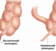 Se doare in partea dreapta, in abdomenul inferior - cauze ale bolilor si particularitatilor…