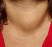 Pacientul tiroidian: tratament, cauze, simptome