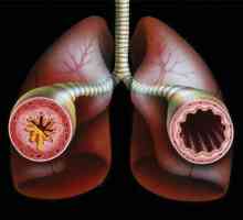 Astm bronșic: cauze și metode de tratament