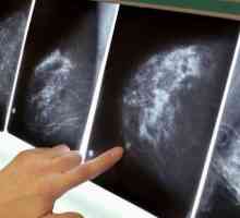 Чем маммография отличается от УЗИ молочных желез? Что информативнее и безопаснее