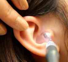 Curățați urechea cu peroxid de hidrogen la domiciliu