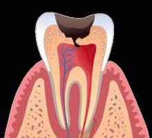 Ce se întâmplă dacă dintele mă doare când o ating?