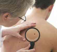 Ce tratează medicul de piele?