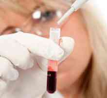 Ce înseamnă testul de sânge AFP? Alfa-fetoproteină: transcript