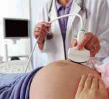 Ce înseamnă ultrasunetele ginecologice?