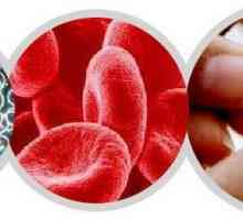 Ce va arăta testarea clinică a sângelui: decodificarea, indicii normali și abaterile