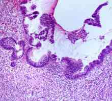 Care este citoplasma celulei. Caracteristicile structurii citoplasmei