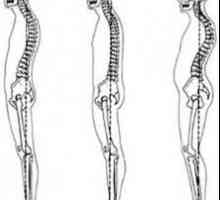 Care sunt curbele fiziologice ale coloanei vertebrale