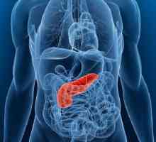 Ce este pancreatita cronica? Simptome, tratament