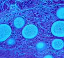 Ce este ciuperca patogenă?