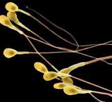 Ce este un spermatozoid? Caracteristicile jocului mascul
