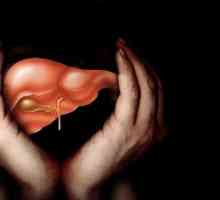 Ciroza hepatică 4 grade: cât de mult trăiesc? perspectivă