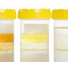 Culoarea urinei este o persoană sănătoasă. Normă și deviații de la ea