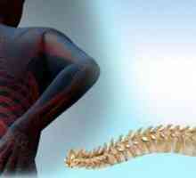 Deformarea coloanei vertebrale: tipuri, cauze, tratament și prevenire