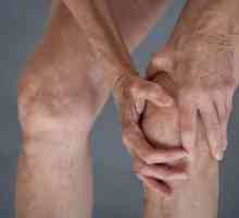 Deformarea artrozei articulației genunchiului de 2 grade: tratament și cauze