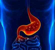 Dieta cu gastrită erozivă a stomacului. Gastrita erozivă: tratament și dietă