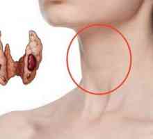 Modificări difuzive ale tiroidianelor: simptome, posibile cauze și caracteristici ale tratamentului