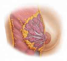 Afecțiuni dismormale ale glandelor mamare: o listă, cauze, diagnostice și metode de tratament